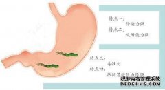 如果“幽门螺杆菌”不起作用，我该怎么办？请