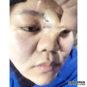 为什么鼻子看起来特别假？
