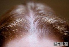 婴儿突然cho住了，我拼命醒了，状况如何？