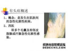 不同，不同和不同的病因。