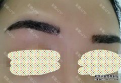 如果我的眉毛变红了怎么办？请注意后果