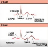 低钾血症需要多长时间？