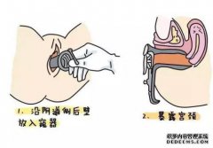 女人的阴道有几种形状！