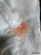 咳嗽假单胞菌是病毒或细菌