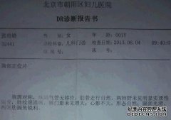什么是右胸痛？