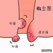一种将环的第二相与第四相的第二相区分开的方