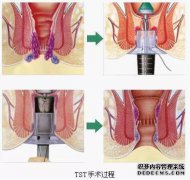 什么是血液剥夺？